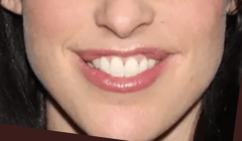 Catherine Reitman's Lips